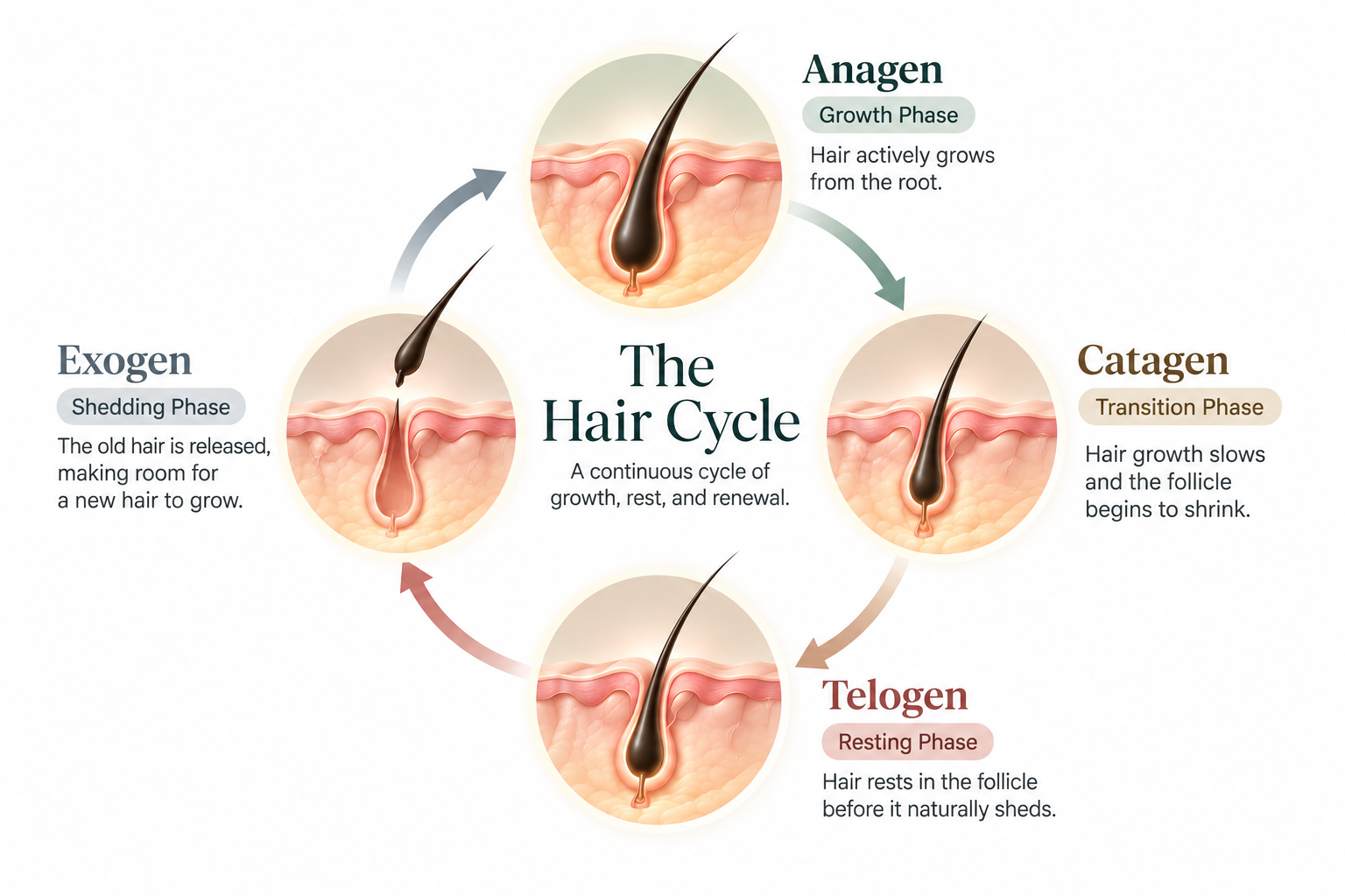 Diagram comparing a healthy hair cycle with a disrupted telogen-effluvium cycle, plus a linear recovery sequence