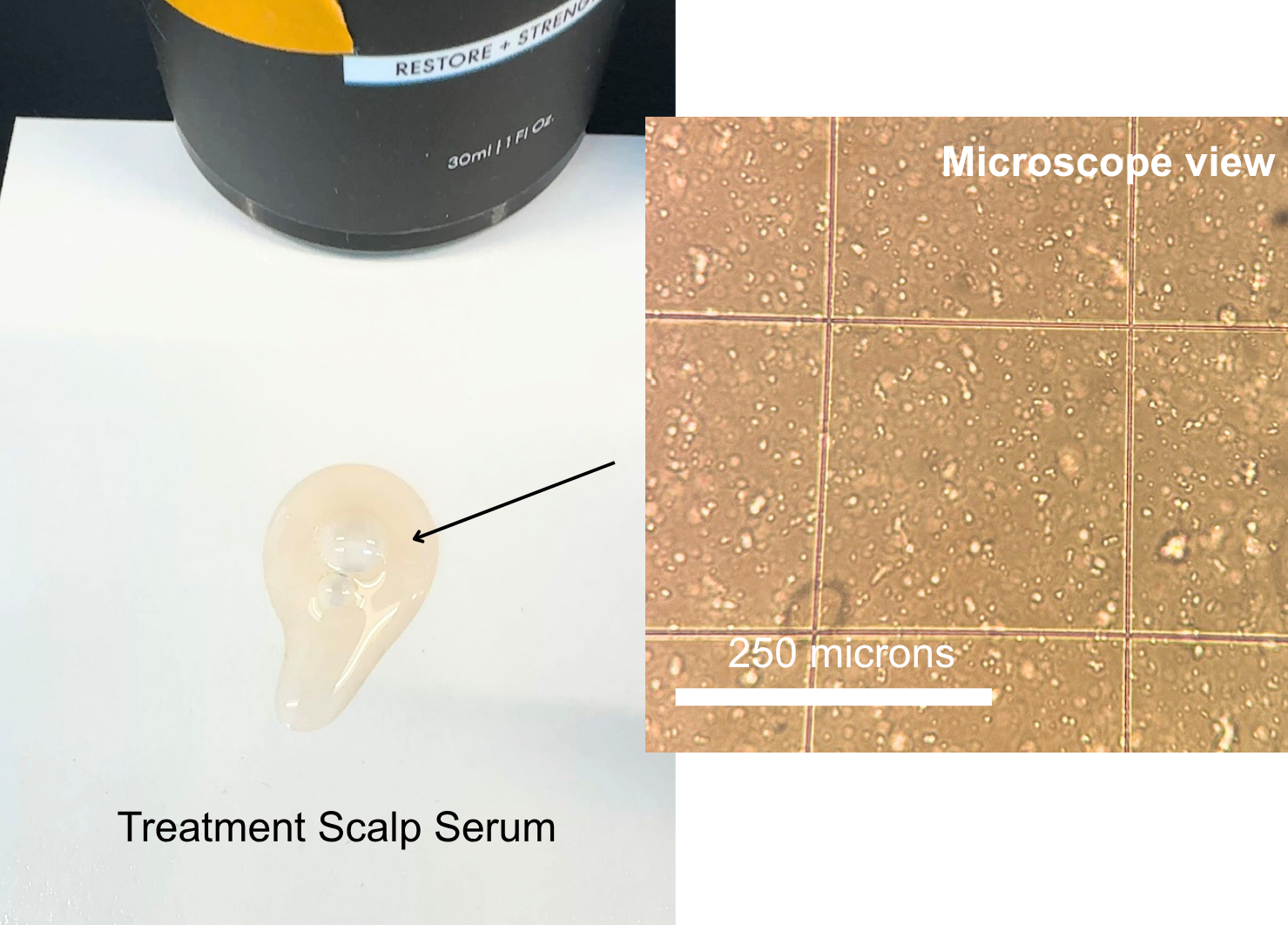 A drop of KilgourMD Treatment Scalp Serum on a white surface beside a microscope view showing numerous particulates, with a 250 micron scale bar
