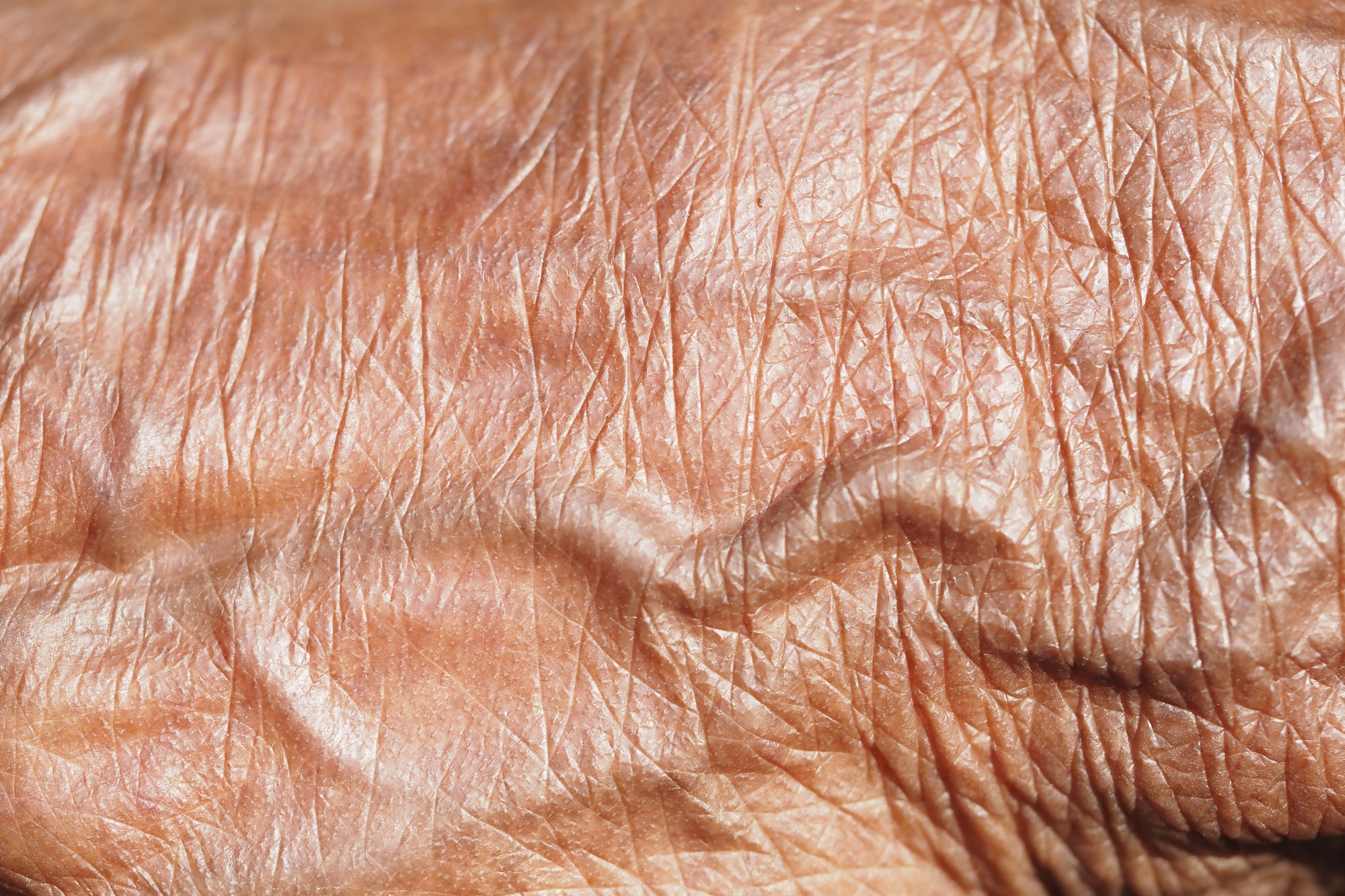 Macro image of skin