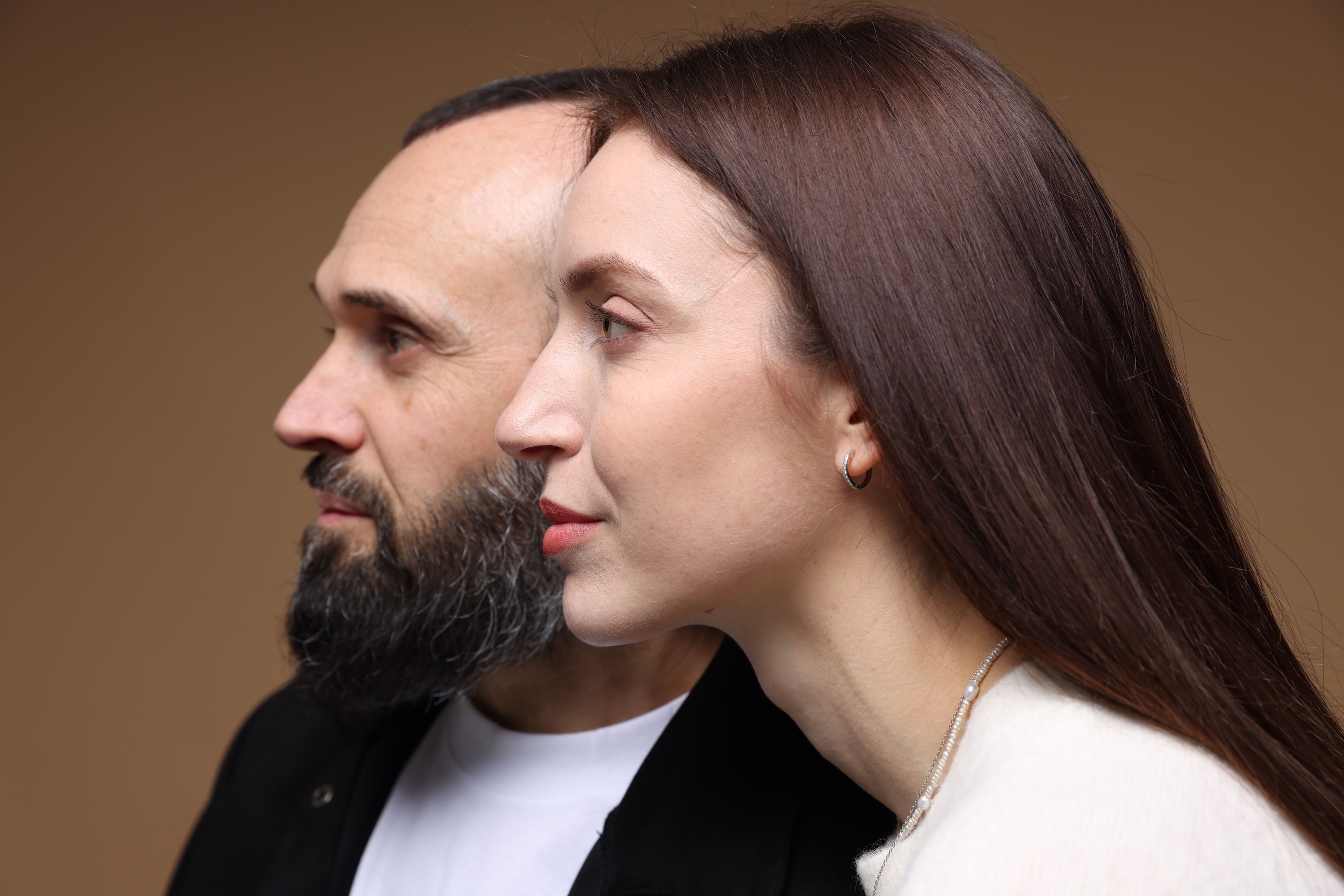 Illustration of female pattern hair loss showing diffuse thinning at the crown