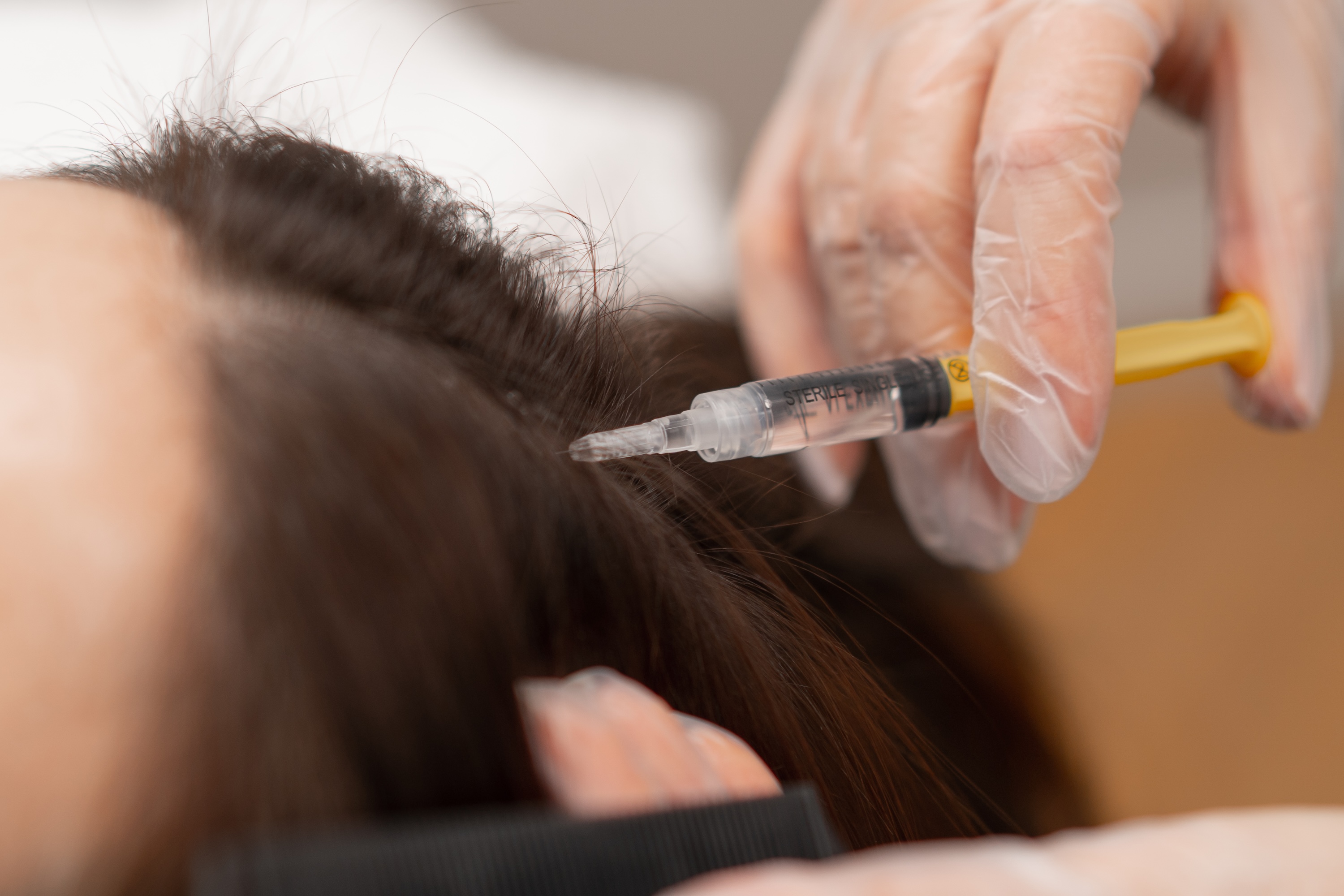 PRP preparation showing blood centrifuge and platelet-rich plasma