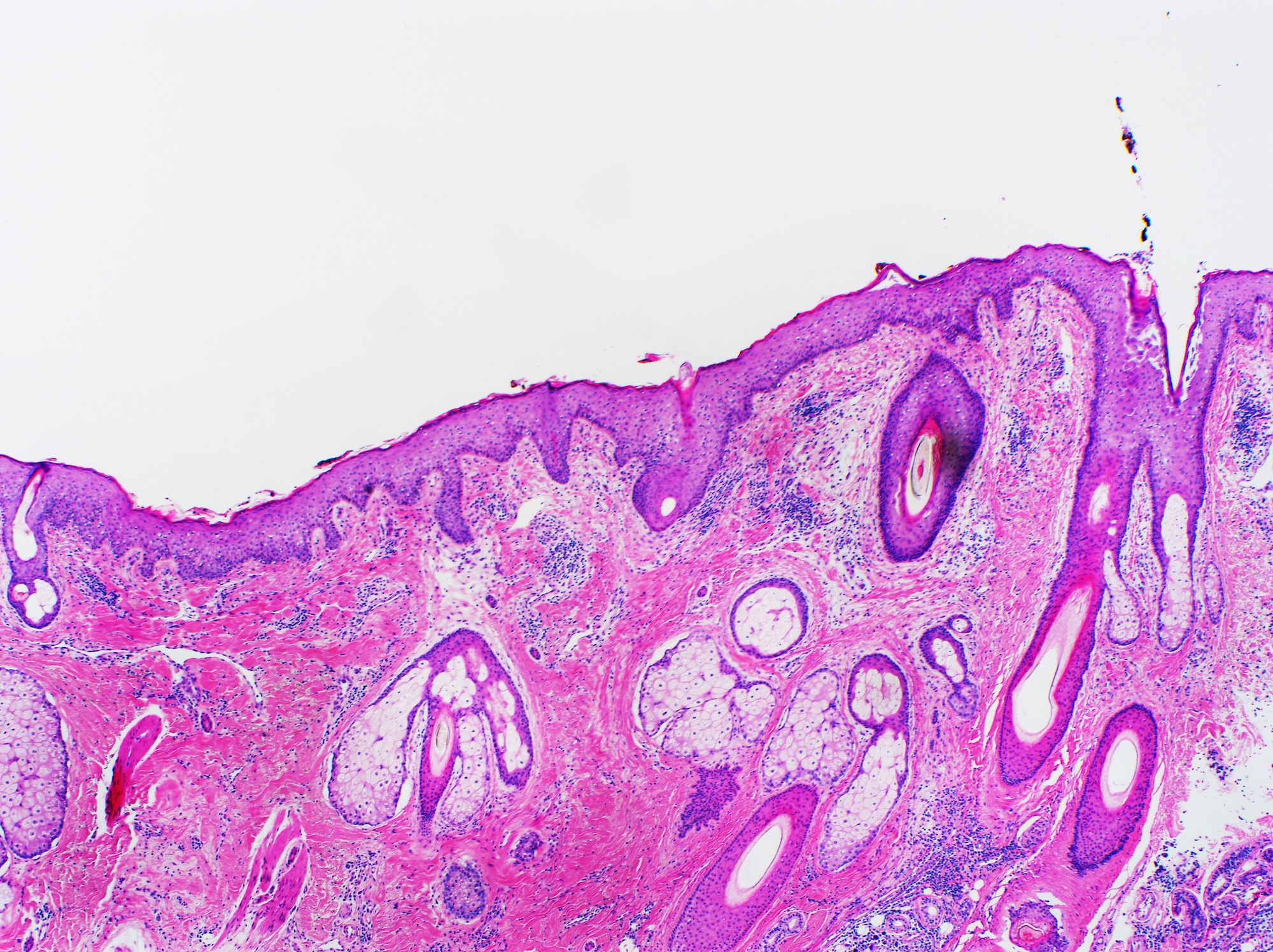 Histological cross-section of human skin showing stratum corneum, epidermis, and dermis layers