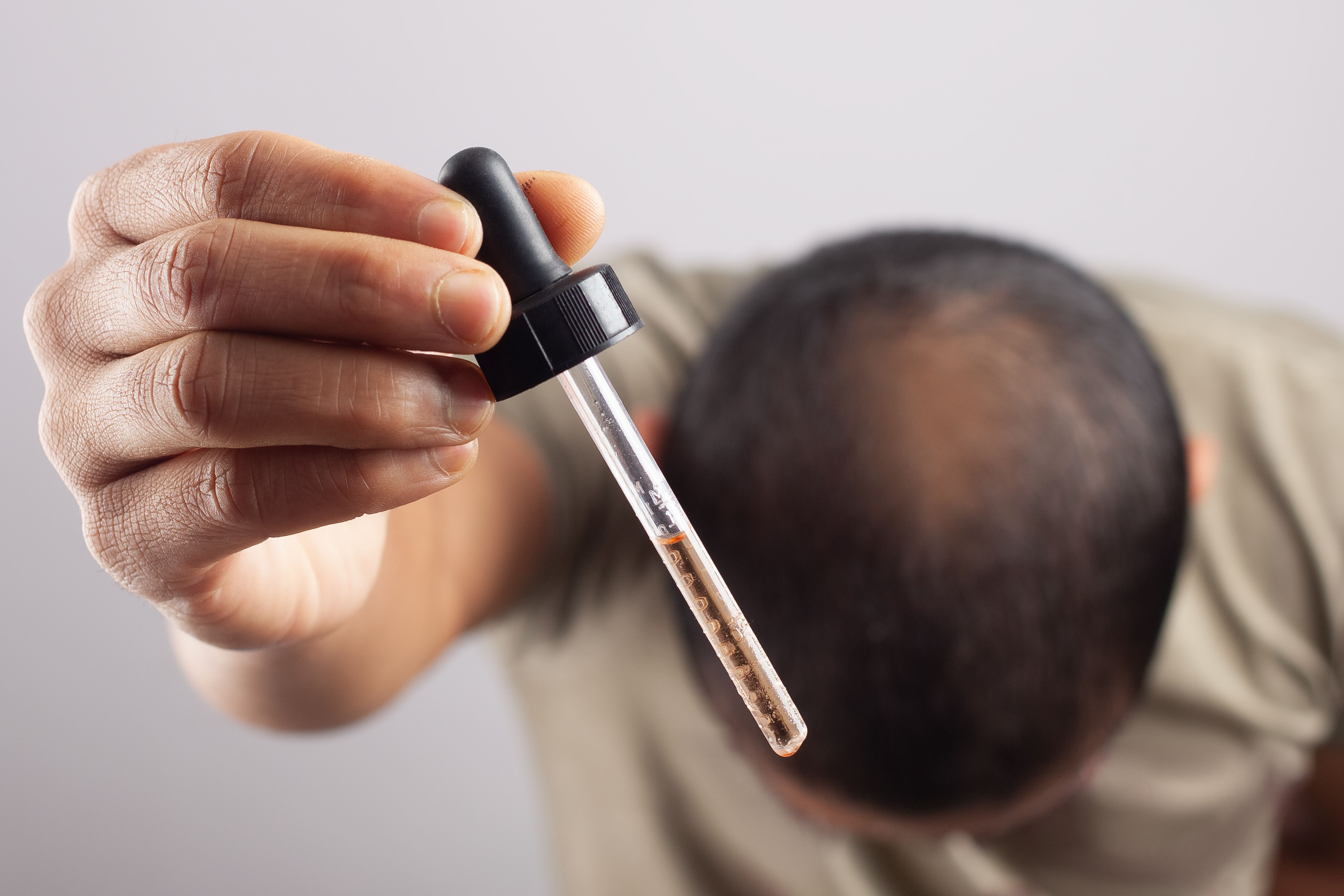 Minoxidil topical solution and oral tablet representing both formulations